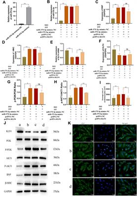 Oxytocin Protects Against Isoproterenol-Induced Cardiac Hypertrophy by Inhibiting PI3K/AKT Pathway via a lncRNA GAS5/miR-375-3p/KLF4-Dependent Mechanism